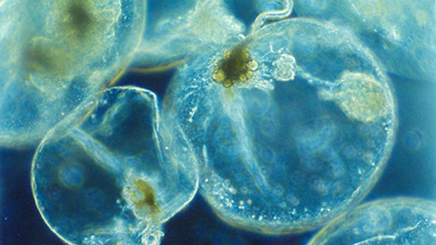 Vista al microscopio de Noctiluca scintillans.