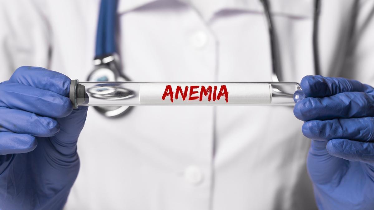 Un médico sujeta en sus manos un tubo de ensayo con la palabra 'anemia'.