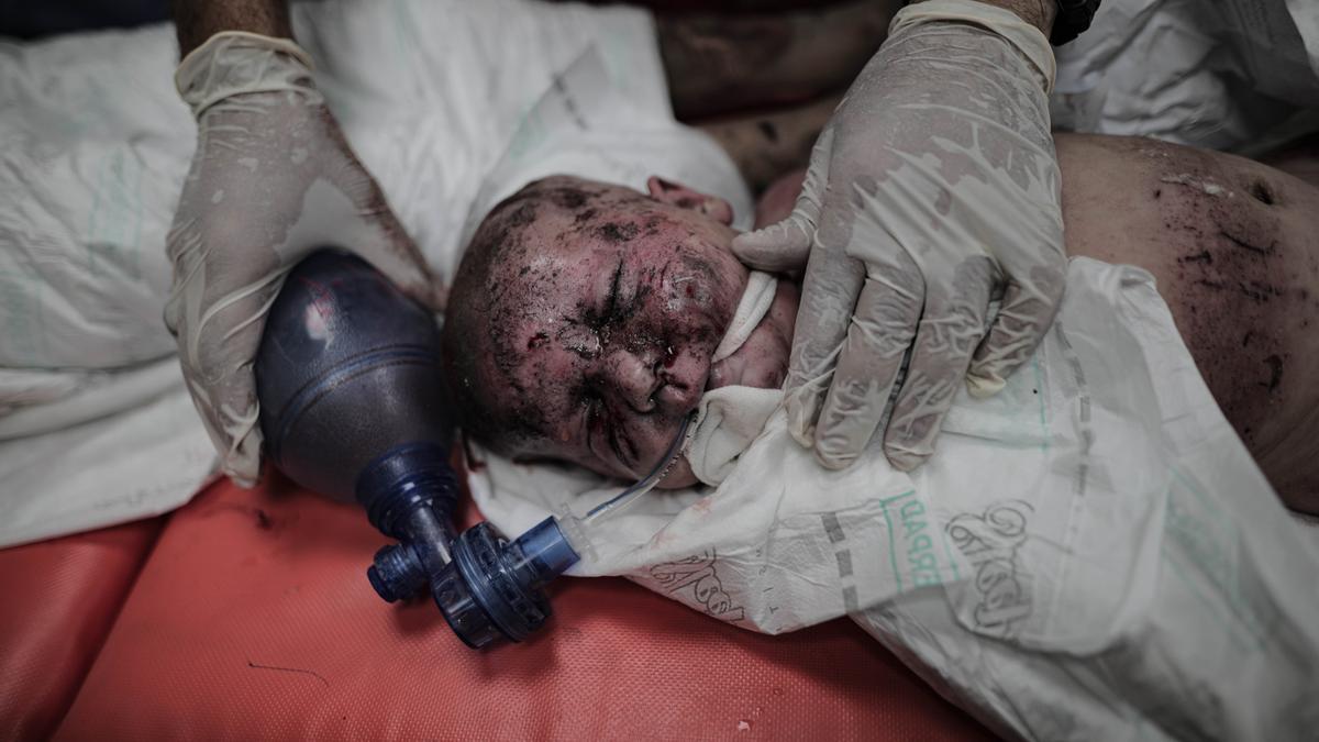 Así era la asistencia médica hace unos días en la Franja.