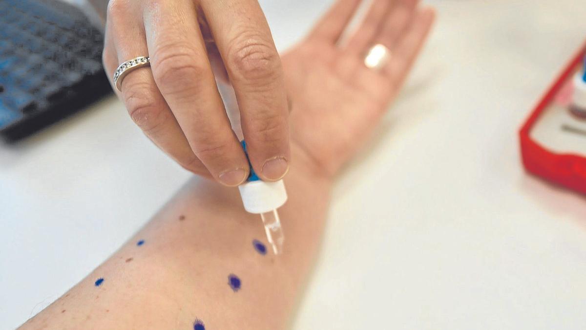 Es importante seguir la pauta de Osakidetza ante casos de alergia.