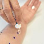 Es importante seguir la pauta de Osakidetza ante casos de alergia.