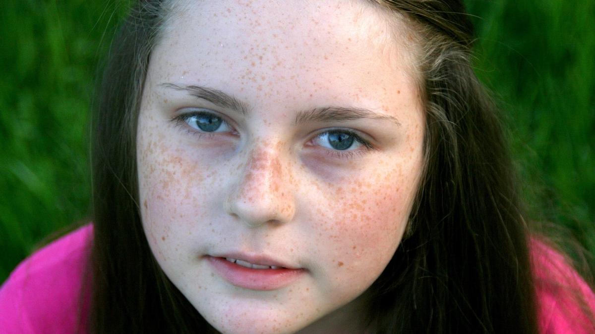 Una niña con pecas en el rostro