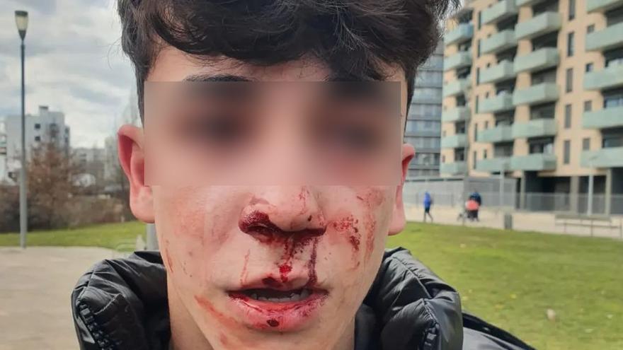 El joven agredido en Vitoria por los dos agentes