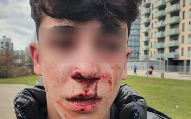 El joven agredido en Vitoria por los dos agentes El joven agredido en Vitoria por los dos agentes
