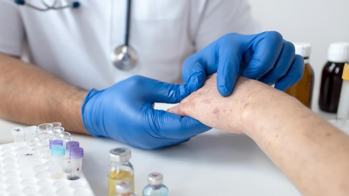 Un sanitario atiende a una persona con una enfermedad en la piel.