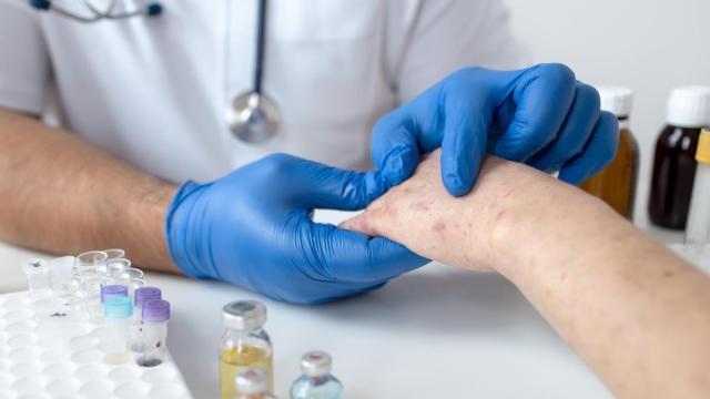 Un sanitario atiende a una persona con una enfermedad en la piel.