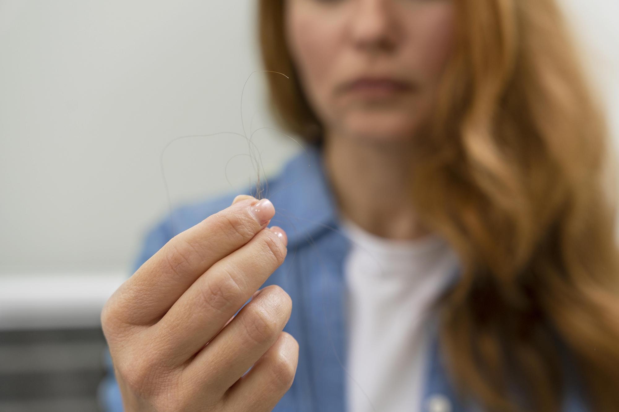 Mujer observa algunos pelos que sostiene en la mano en una época de caída capilar más intensa.