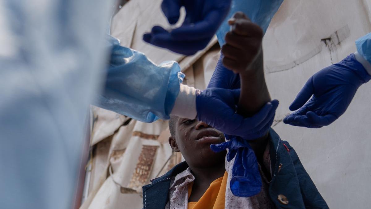 Un joven recibe el tratamiento de mpox en un centro médico de República Democrática del Congo.