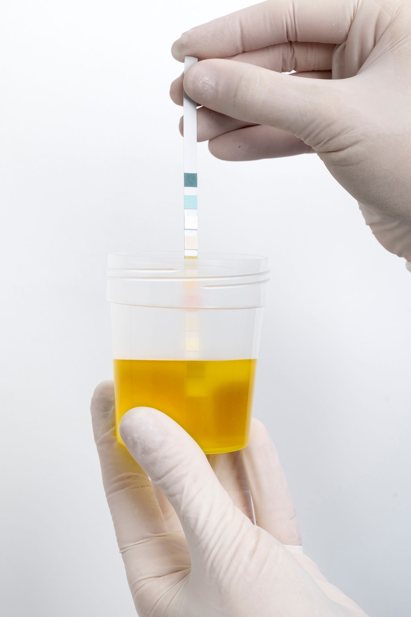 Un profesional analiza una muestra de orina en un laboratorio.