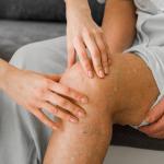 Las varices son venas inflamadas de color azul o morado que suelen aparecen en las piernas