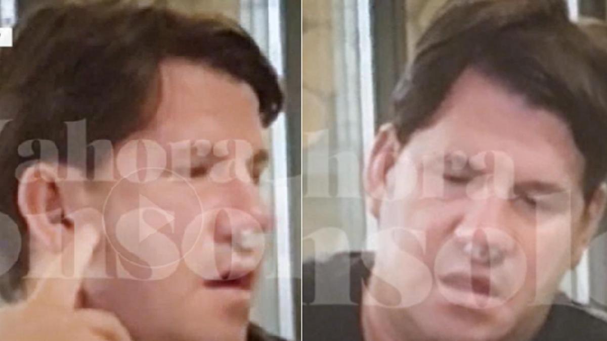 El cantante se ha sometido a una compleja intervención con la que busca recuperar la forma original de su nariz.