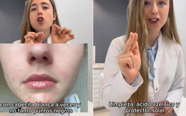 La dermatóloga recomienda seguir una rutina muy sencilla de tres pasos para acabar con este trastorno.