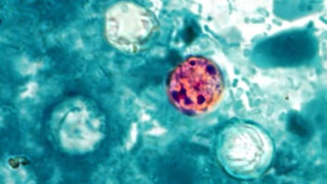 El parásito el parásito 'Cyclospora cayetanensis'.