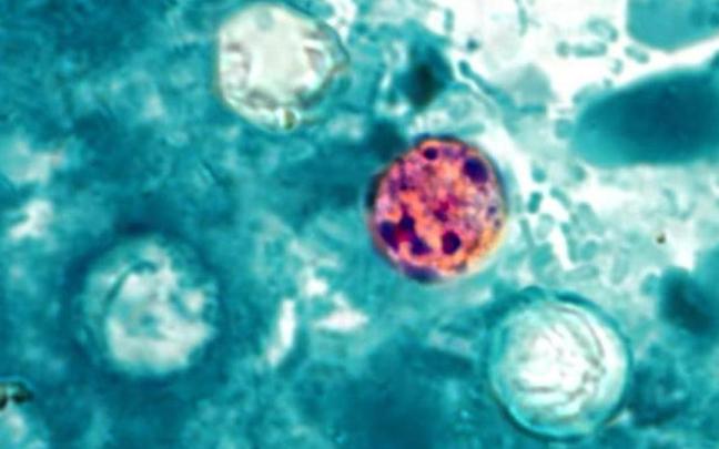 El parásito el parásito 'Cyclospora cayetanensis'.