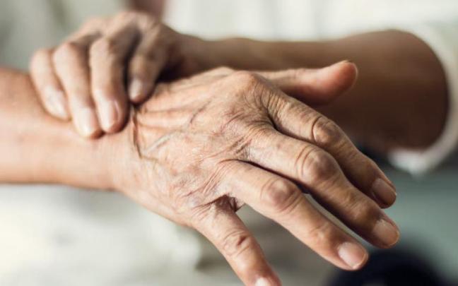 El riesgo de Parkinson se duplica en personas con ansiedad / EFE El riesgo de Parkinson se duplica en personas con ansiedad