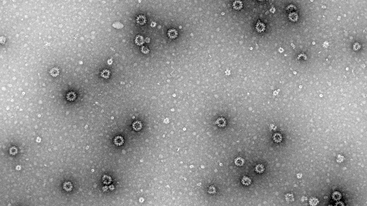Identifican el papel de una enzima clave en la infección por rotavirus y norovirus, causantes de gastroenteritis