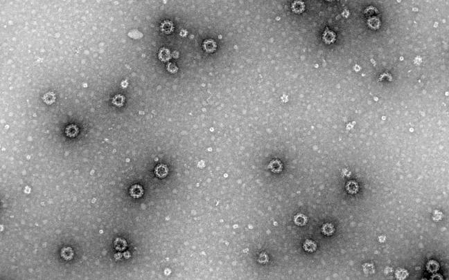 Identifican el papel de una enzima clave en la infección por rotavirus y norovirus, causantes de gastroenteritis