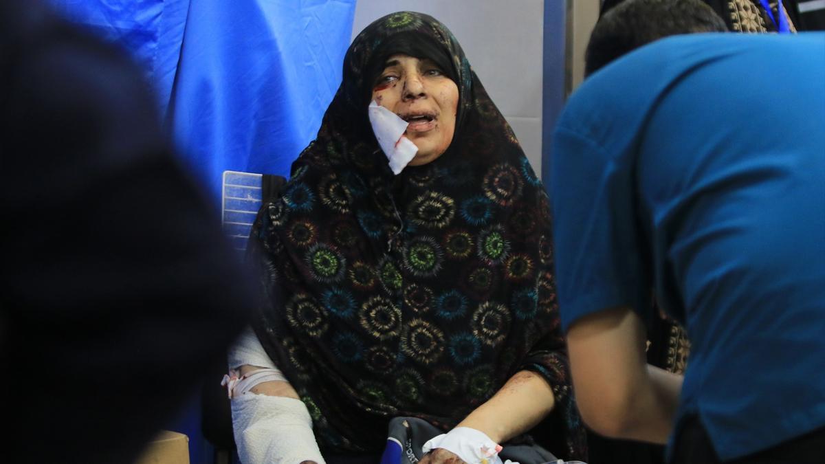 Una mujer herida por los bombardeos israelíes es tratada en un hospital en Ciudad de Gaza.