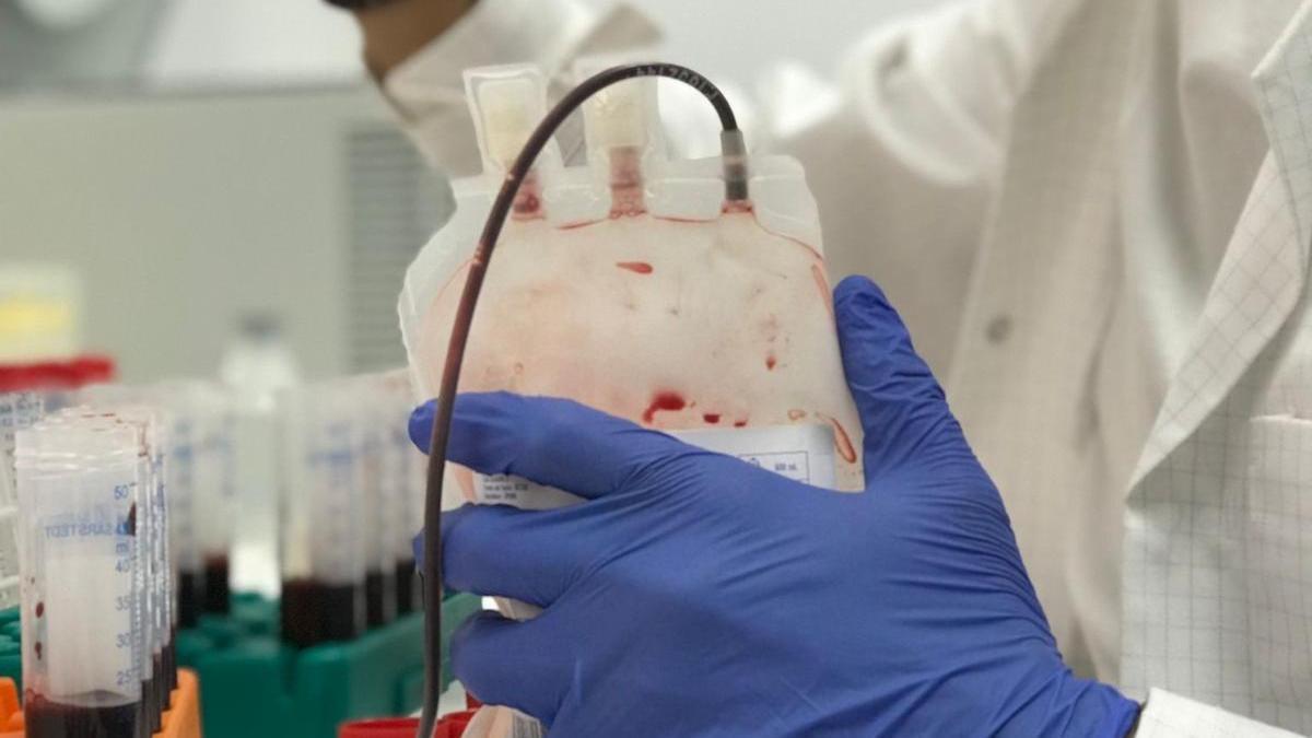 Investigadores de IBIMA Plataforma BIONAND desarrollan una novedosa metodología para el diagnóstico precoz de cáncer de mama con una sola muestra de sangre.