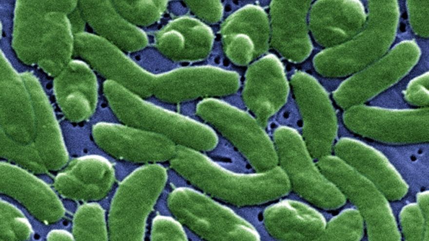Imagen al microscopio, coloreada, de la bacteria 'Vibrio vulnificus'