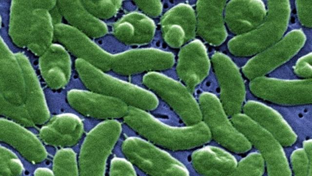 Imagen al microscopio, coloreada, de la bacteria 'Vibrio vulnificus'