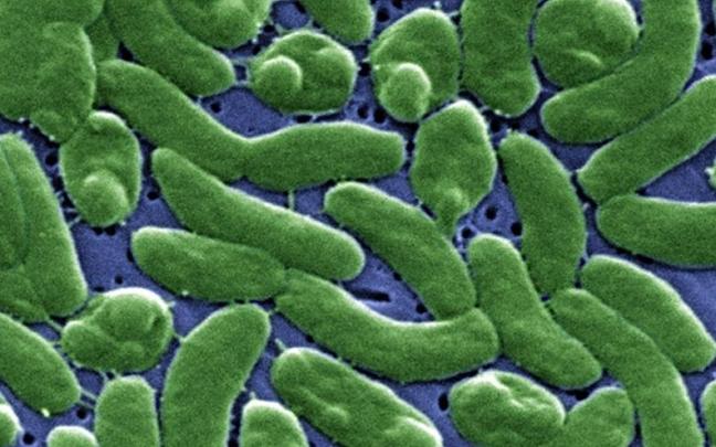 Imagen al microscopio, coloreada, de la bacteria 'Vibrio vulnificus'