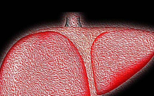 El h&iacute;gado no duele, por lo que resulta m&aacute;s d&iacute;ficil de detectar la enfermedad.