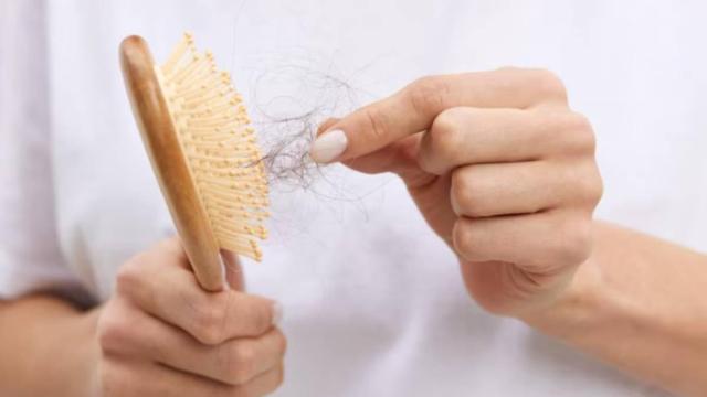 La ciencia tiene algunas respuestas, y los especialistas en dermatología capilar ayudan a entender un proceso natural que, aunque molesto, forma parte del ciclo de vida del cabello / Freepik La ciencia tiene algunas respuestas, y los especialistas en dermatología capilar ayudan a entender un proceso natural que, aunque molesto, forma parte del ciclo de vida del cabello
