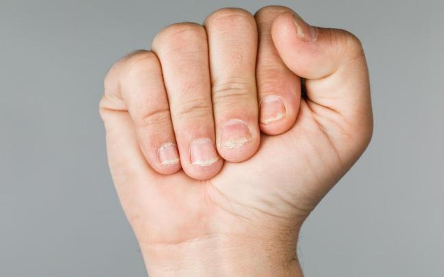 Uñas descuidadas. Uñas descuidadas.