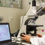 Investigación del nanomedicamento para tratar la enfermedad rara de Fabry.