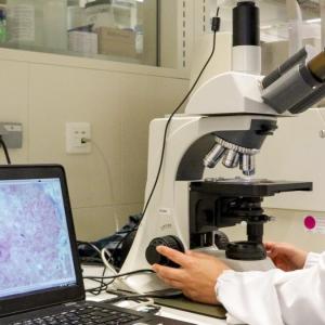 Investigación del nanomedicamento para tratar la enfermedad rara de Fabry.