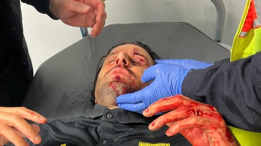 El italiano Fabio Grosso, herido tras los incidentes en Marsella.