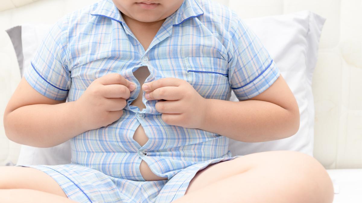 Hay casi el doble de niños con obesidad que niñas.
