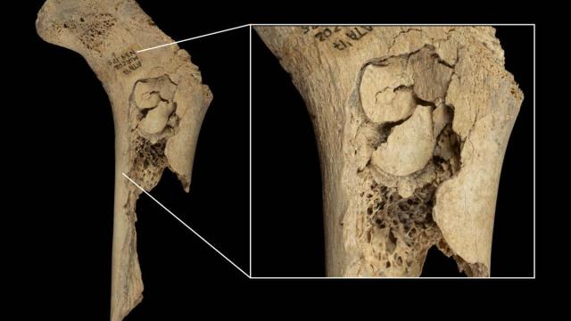 Descubierto un episodio de canibalismo durante el Neolítico final en la cueva de El Mirador en Atapuerca Descubierto un episodio de canibalismo durante el Neolítico final en la cueva de El Mirador en Atapuerca