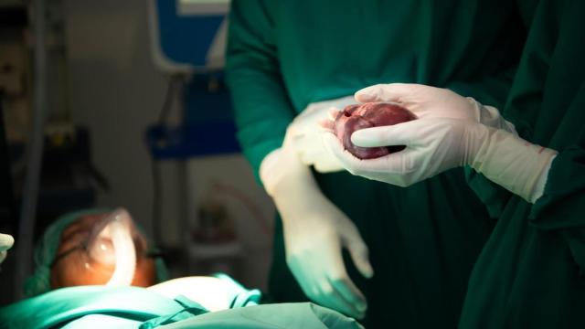 Intervención quirúrgica para un trasplante de corazón