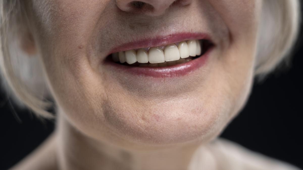 La importancia de la dieta en los dientes