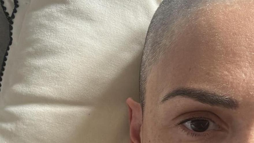 Lara con la cabeza rapada tras diagnosticarle que padece cáncer de mama.