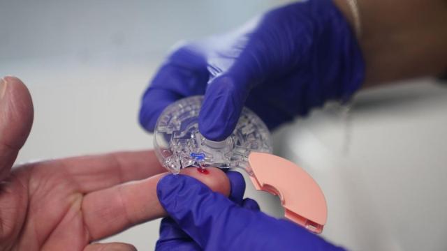 Toma de una muestra de sangre para el control de azucar en la sangre.