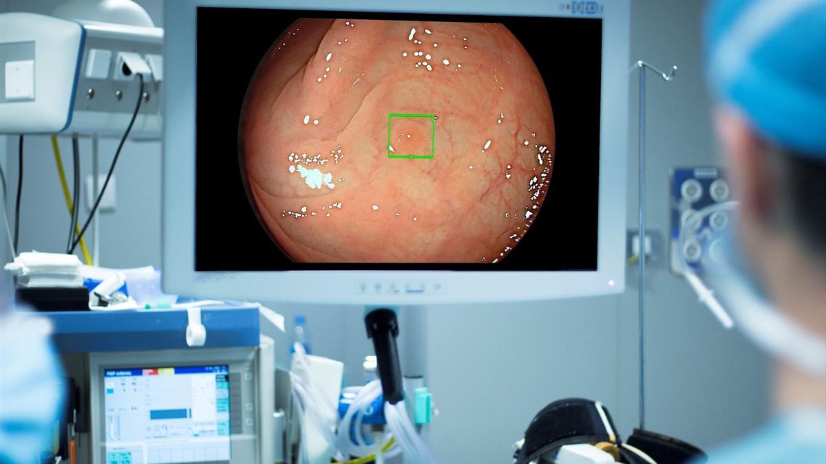 Un profesional sanitario realiza una colonoscopia en una foto de archivo.