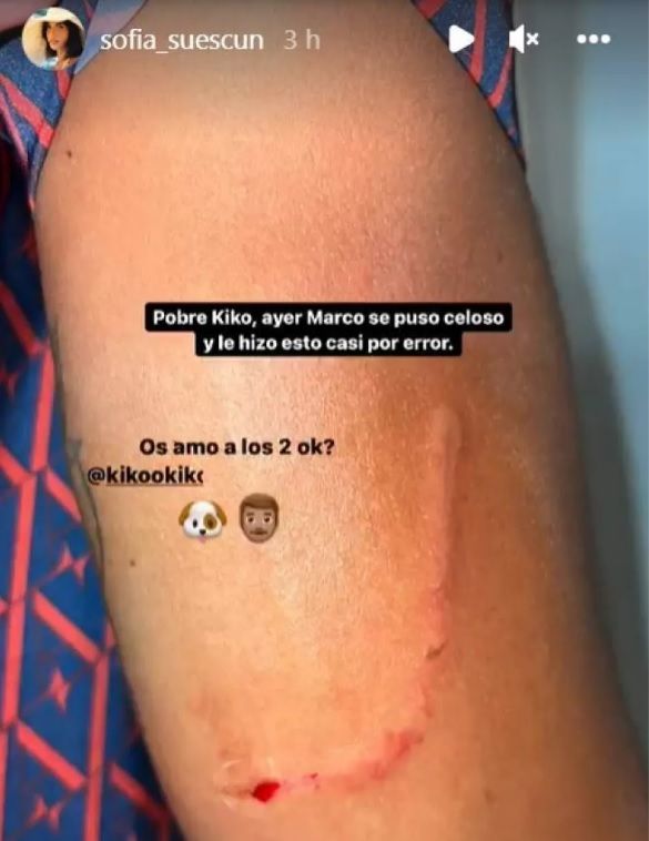 El arañazo de Kiko Jiménez.