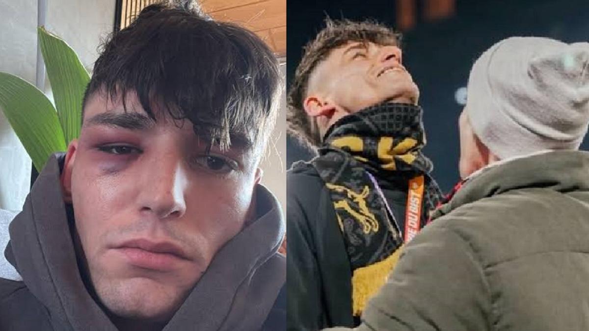 El árbitro, tras la agresión (i) y al pedir matrimonio a su novio.