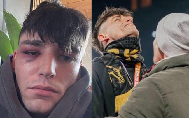 El árbitro, tras la agresión (i) y al pedir matrimonio a su novio.