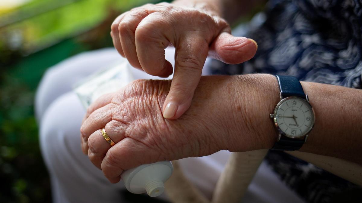 La artritis afecta a las articulaciones y causa dolor, rigidez y pérdida de movimiento