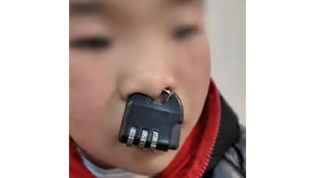 El niño, con el candado en la nariz.