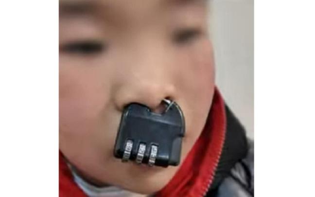 El niño, con el candado en la nariz.