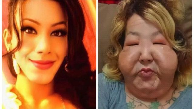 El antes y el después de la influencer.