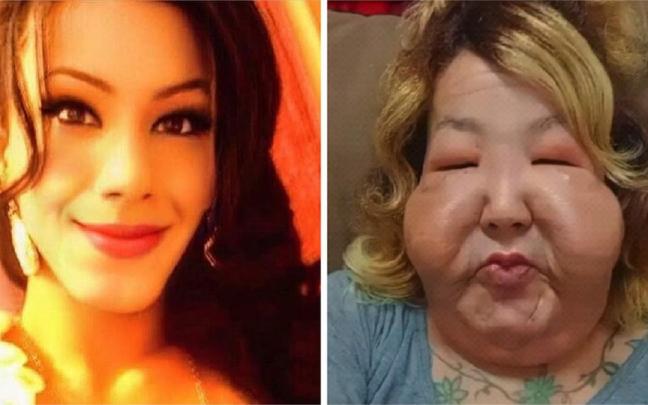 El antes y el después de la influencer.