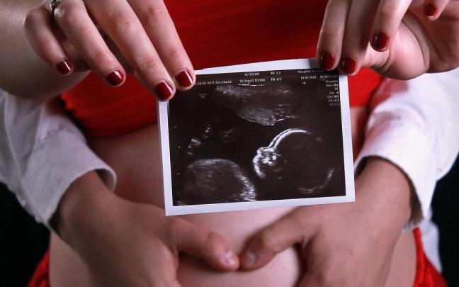 Una mujer muestra una imagen de su bebé. Una mujer muestra una imagen de su bebé.