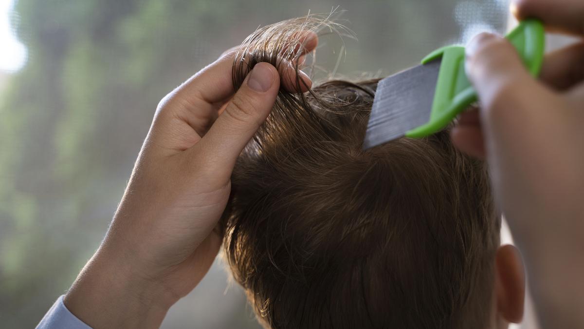 La lendrera hay que pasarla mechón a mechón y de abajo arriba.
