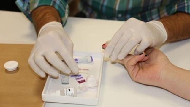 Test rápido para la detección del VIH.